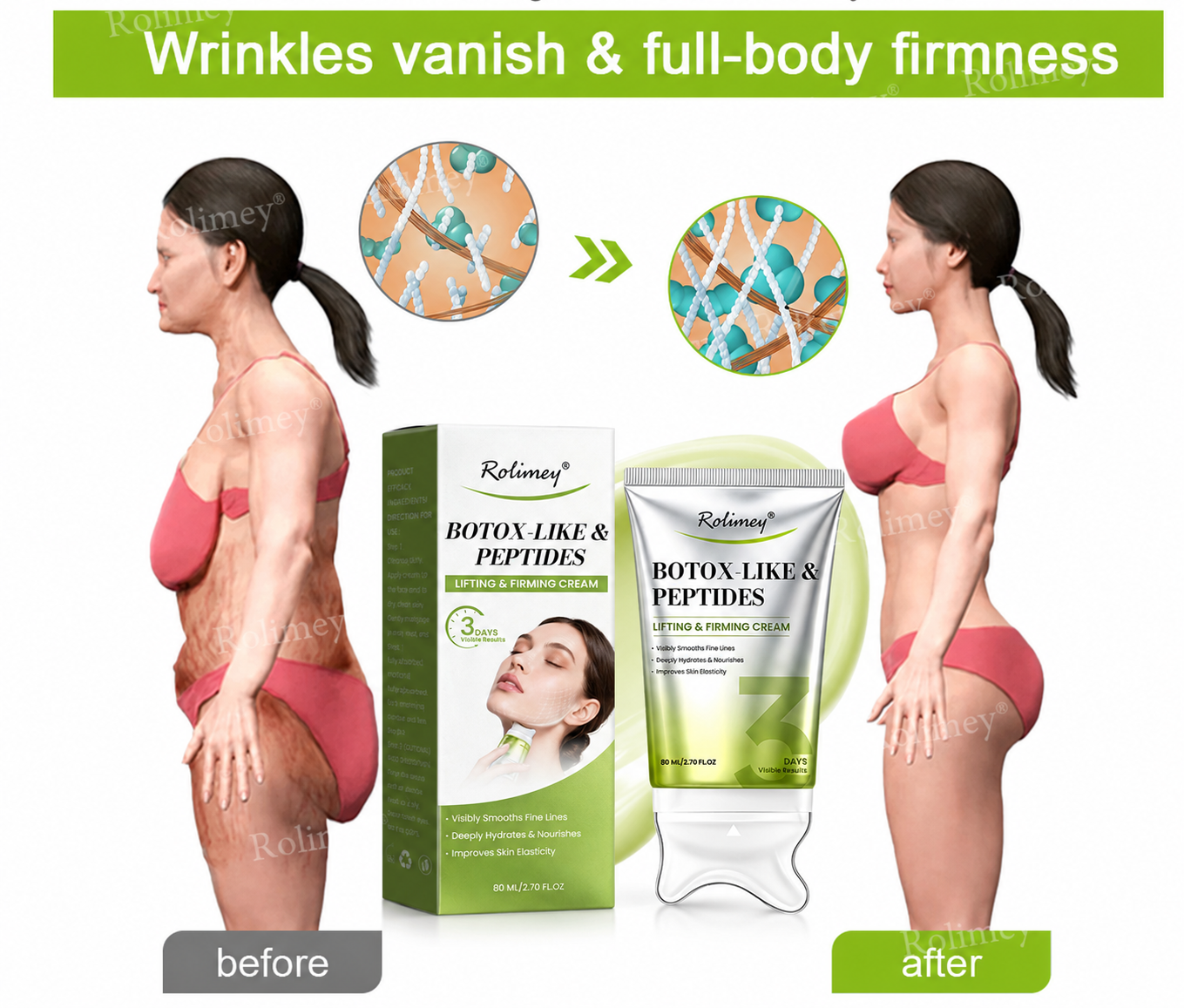 🟢Rolimey® BOTOX LIKE PEPTITES MICRO-NEEDLE Wrinkle-Lift Tightening cream