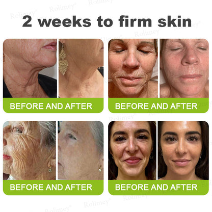 👑✨Made and shipped from the UK ✅ Rolimey® Botox & Vita-A Retinol Shot Wrinkle-Lift Tightening stick