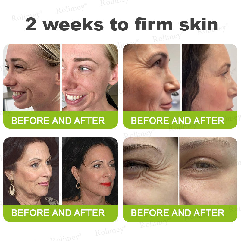 👑✨Made and shipped from the UK ✅ Rolimey® Botox & Vita-A Retinol Shot Wrinkle-Lift Tightening stick
