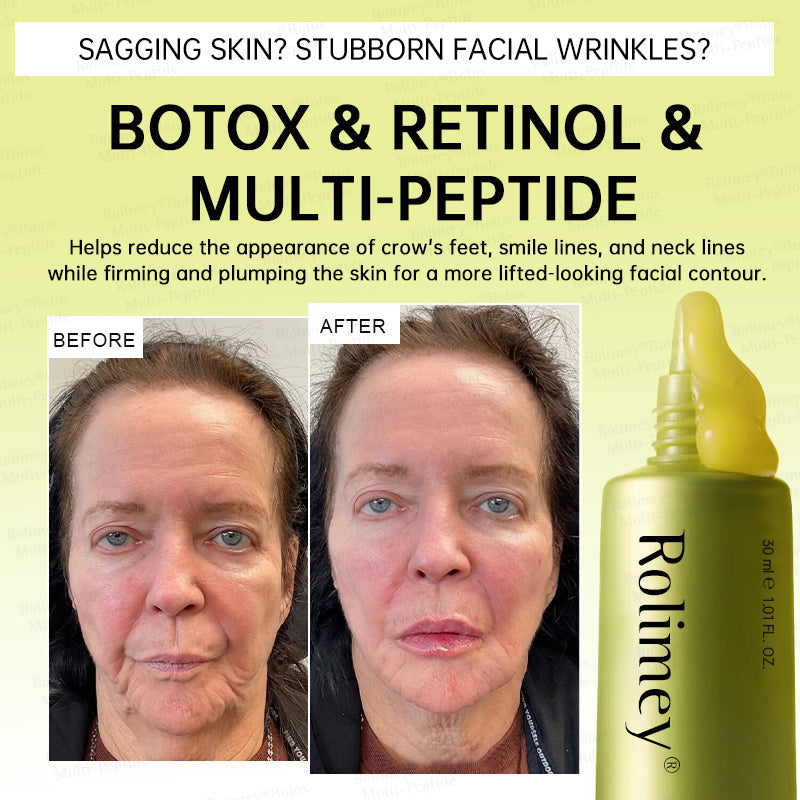💐🌟💛Rolimey® Multi-Peptide Retinol Shot Wrinkle-Lift Cream