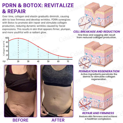 🥈🥈💫Celsiora® Botox & PDRN Anti-Wrinkle Shot – Lift & Firming Cream