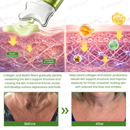 💍🟢Rolimey® Vita-A Retinol Shot Wrinkle-Lift Tightening cream\