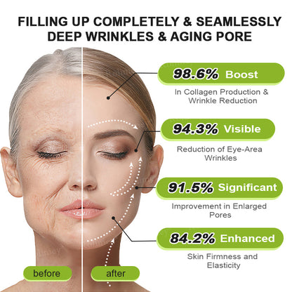 💖🎊🎐Made and shipped from the UK 💫Rolimey® Botox & Vita-A Retinol Shot Wrinkle-Lift Tightening cream - Last Day Promotion 70% OFF