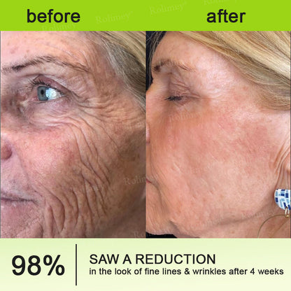 💖🎊🎐Made and shipped from the UK 💫Rolimey® Botox & Vita-A Retinol Shot Wrinkle-Lift Tightening cream - Last Day Promotion 70% OFF