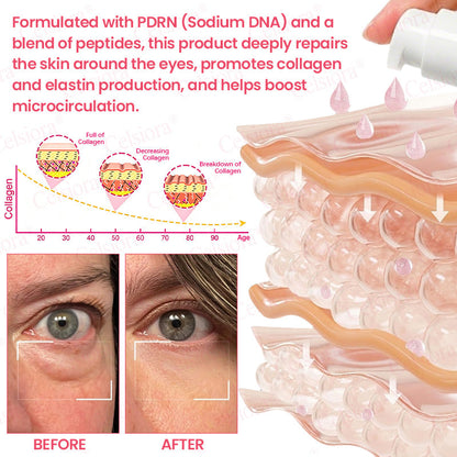 🍃Celsiora® PDRN Pink Peptide Eye Cream