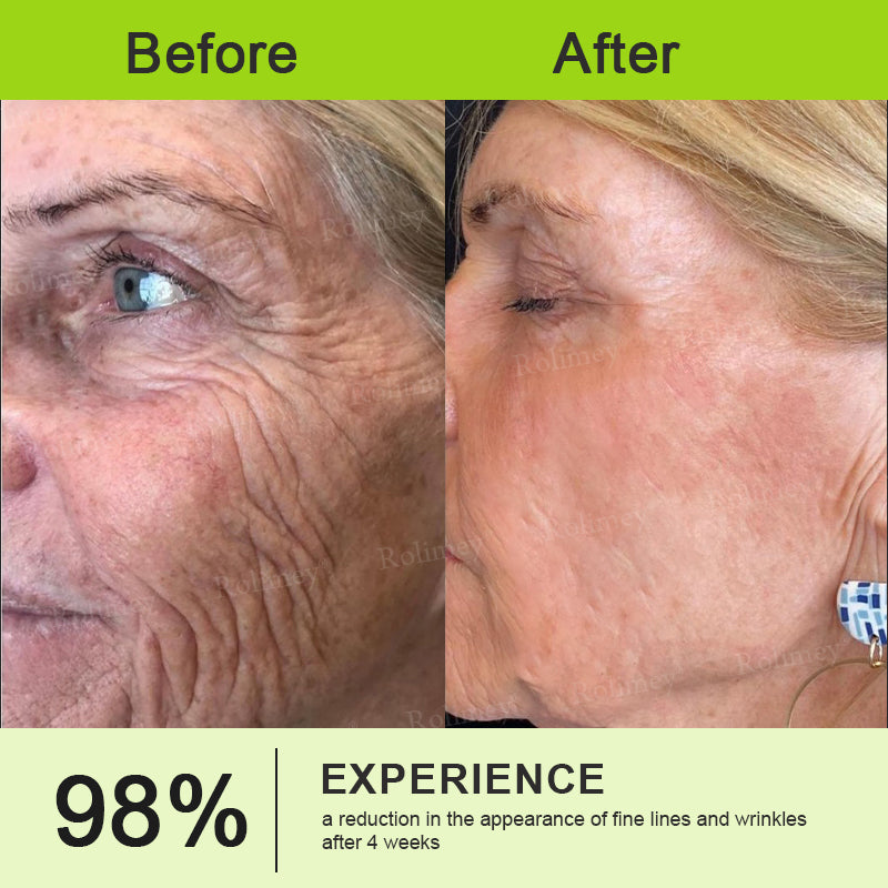👑✨Made and shipped from the UK ✅ Rolimey® Botox & Vita-A Retinol Shot Wrinkle-Lift Tightening stick