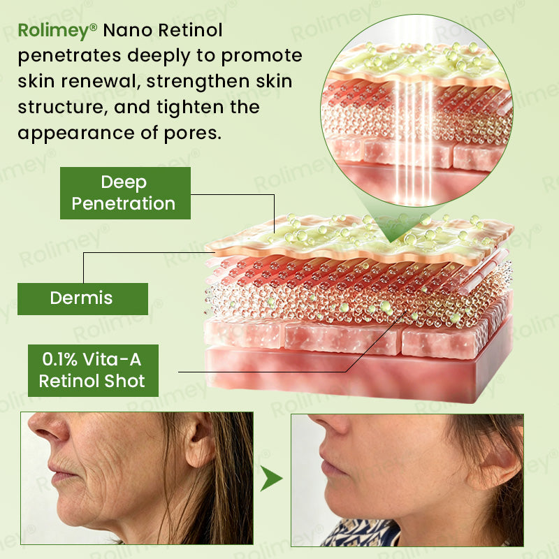 💍🟢Rolimey® Vita-A Retinol Shot Wrinkle-Lift Tightening cream\