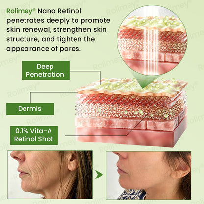 💍🟢Rolimey® Vita-A Retinol Shot Wrinkle-Lift Tightening cream\