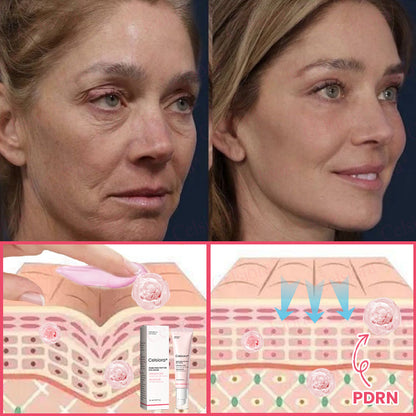 🍃Celsiora® PDRN Pink Peptide Eye Cream