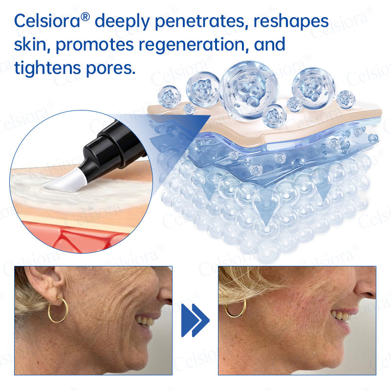 🎁✨Made and shipped from the UK 💫Celsiora® Botox & PDRN Anti-Wrinkle Shot – Lift & Firming Cream- Last Day Promotion 70% OFF