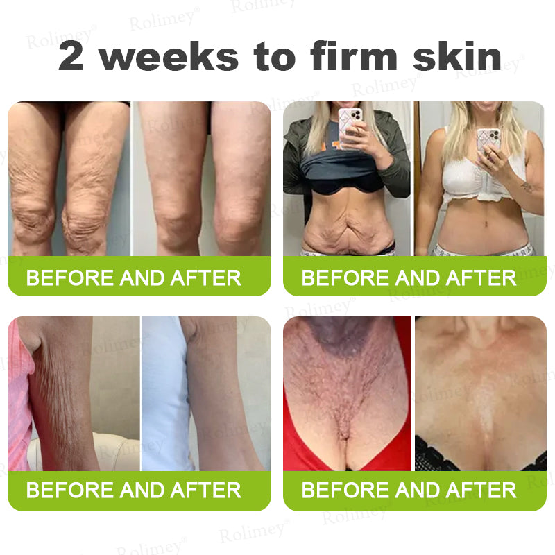 💖🎊🎐Made and shipped from the UK 💫Rolimey® Botox & Vita-A Retinol Shot Wrinkle-Lift Tightening cream - Last Day Promotion 70% OFF
