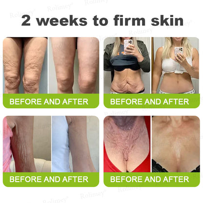 💖🎊🎐Made and shipped from the UK 💫Rolimey® Botox & Vita-A Retinol Shot Wrinkle-Lift Tightening cream - Last Day Promotion 70% OFF