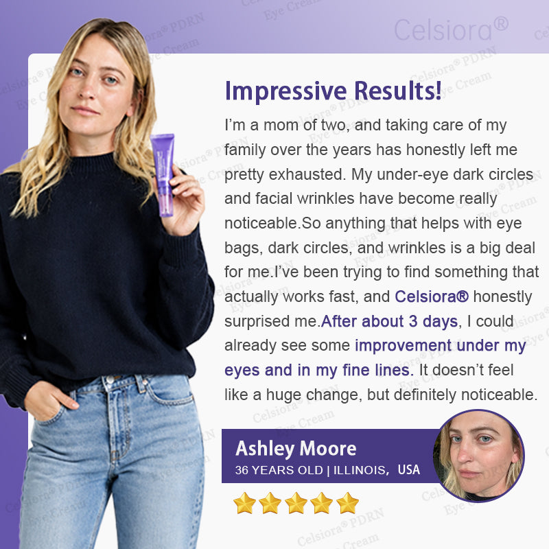 🏅✨Celsiora® PDRN Renewal Complex Eye Cream | Wrinkles, Puffiness & Dark Circles