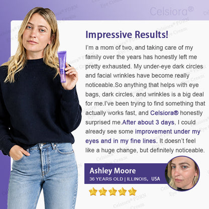 🏅✨Celsiora® PDRN Renewal Complex Eye Cream | Wrinkles, Puffiness & Dark Circles