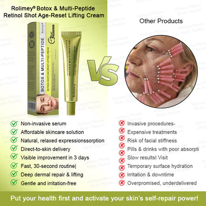💐🌟💛Rolimey® Multi-Peptide Retinol Shot Wrinkle-Lift Cream