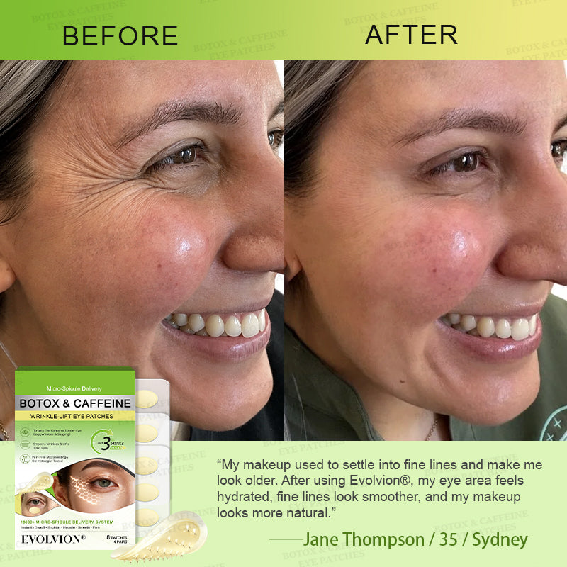 👁️🌿UK HOT SALES ✨Evolvion® Botox & Caffeine Wrinkle-Lift Eye Patches