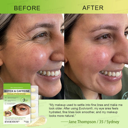 👁️🌿UK HOT SALES ✨Evolvion® Botox & Caffeine Wrinkle-Lift Eye Patches