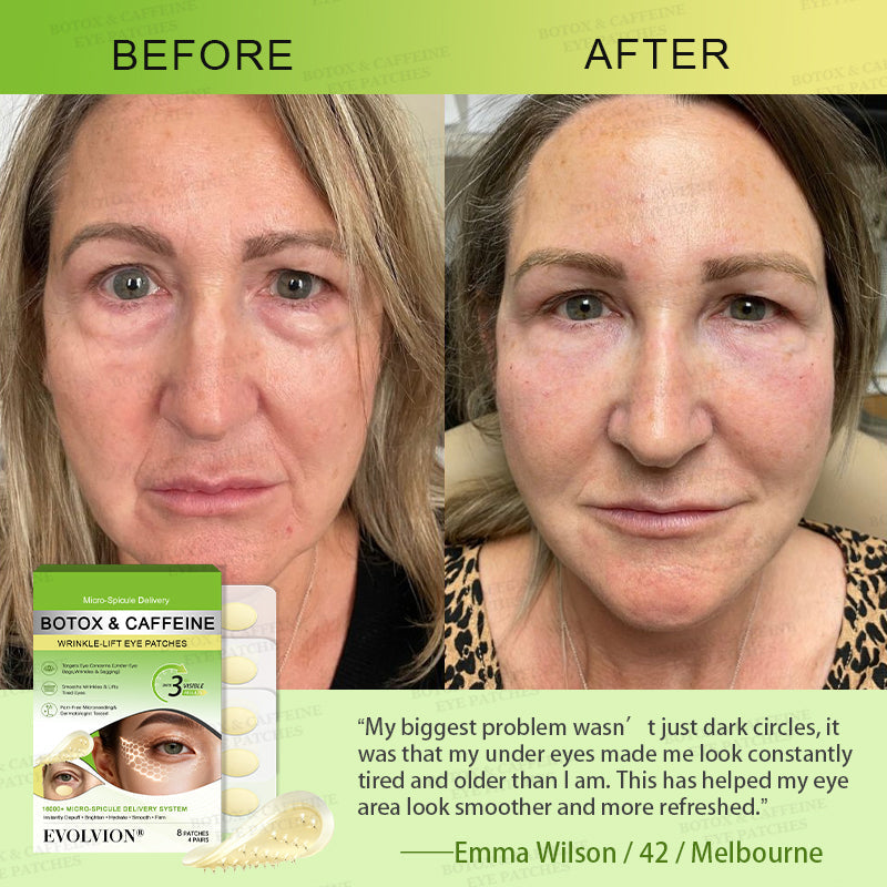 👁️🌿UK HOT SALES ✨Evolvion® Botox & Caffeine Wrinkle-Lift Eye Patches