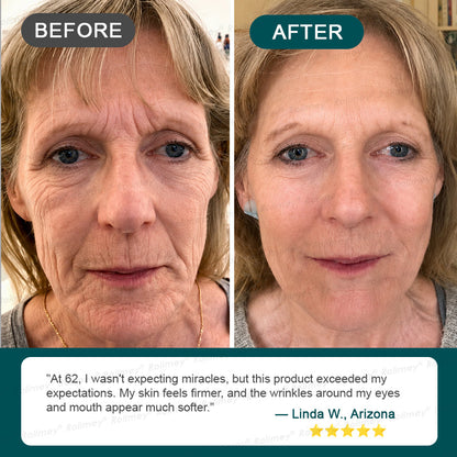 Rolimey® Botox & Stem Cell Wrinkle-Lift Tightening Cream