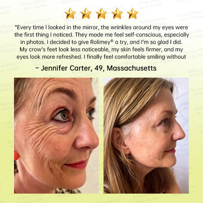 💐🌟💛Rolimey® Multi-Peptide Retinol Shot Wrinkle-Lift Cream
