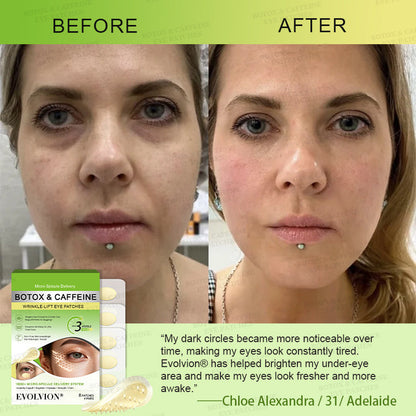 👁️🌿UK HOT SALES ✨Evolvion® Botox & Caffeine Wrinkle-Lift Eye Patches