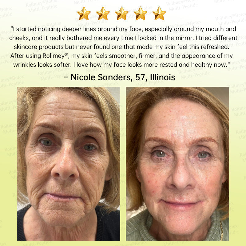 💐🌟💛Rolimey® Multi-Peptide Retinol Shot Wrinkle-Lift Cream