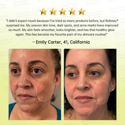 💐🌟💛Rolimey® Multi-Peptide Retinol Shot Wrinkle-Lift Cream