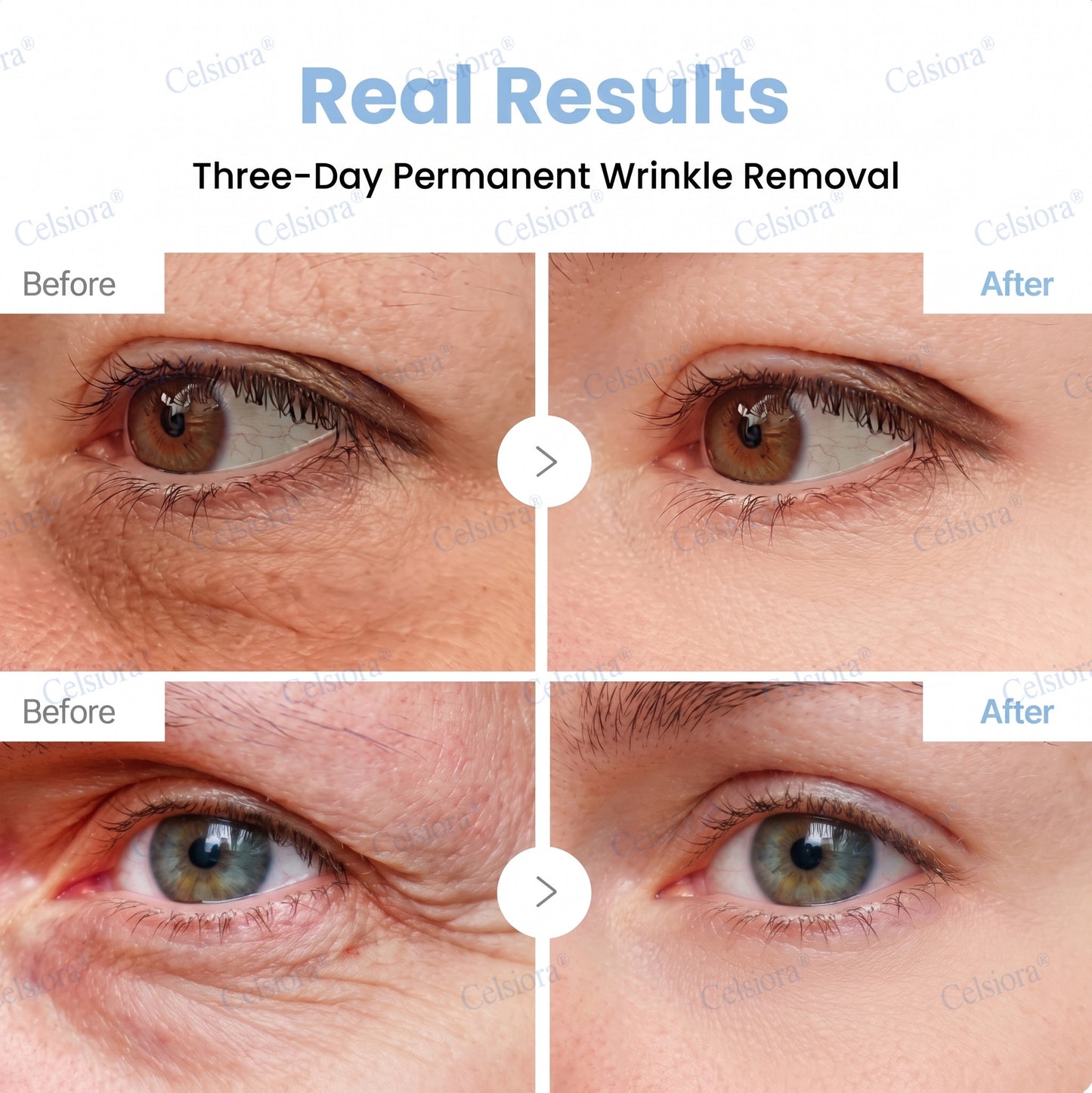🎁✨Made and shipped from the UK 💫Celsiora® Botox & PDRN Anti-Wrinkle Shot – Lift & Firming Cream- Last Day Promotion 70% OFF