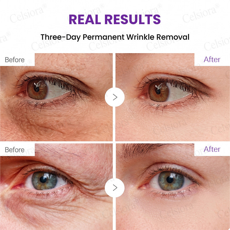 🥈🥈💫Celsiora® Botox & PDRN Anti-Wrinkle Shot – Lift & Firming Cream