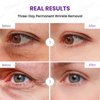 🥈🥈💫Celsiora® Botox & PDRN Anti-Wrinkle Shot – Lift & Firming Cream