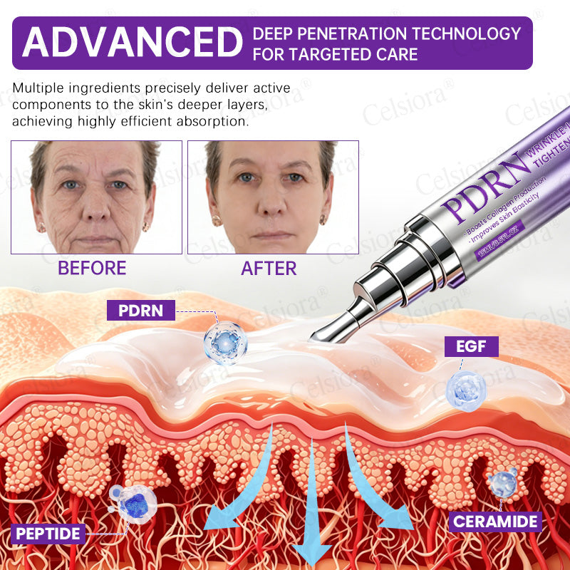 🥈🥈💫Celsiora® Botox & PDRN Anti-Wrinkle Shot – Lift & Firming Cream