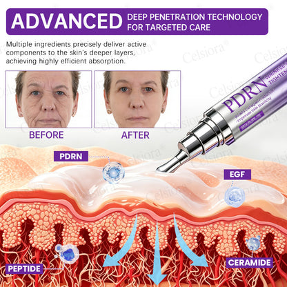 🥈🥈💫Celsiora® Botox & PDRN Anti-Wrinkle Shot – Lift & Firming Cream