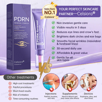 🏅✨Celsiora® PDRN Renewal Complex Eye Cream | Wrinkles, Puffiness & Dark Circles