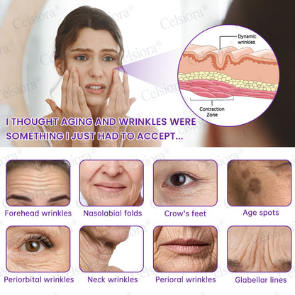 🥈🥈💫Celsiora® Botox & PDRN Anti-Wrinkle Shot – Lift & Firming Cream