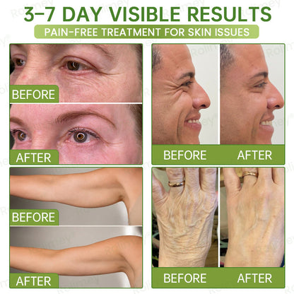 💍🟢Rolimey® Vita-A Retinol Shot Wrinkle-Lift Tightening cream\