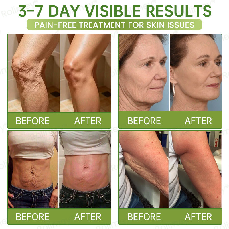 💍🟢Rolimey® Vita-A Retinol Shot Wrinkle-Lift Tightening cream\