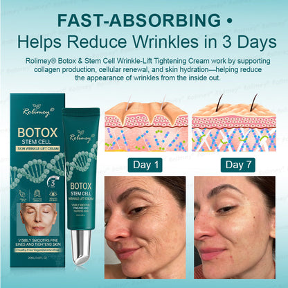 Rolimey® Botox & Stem Cell Wrinkle-Lift Tightening Cream