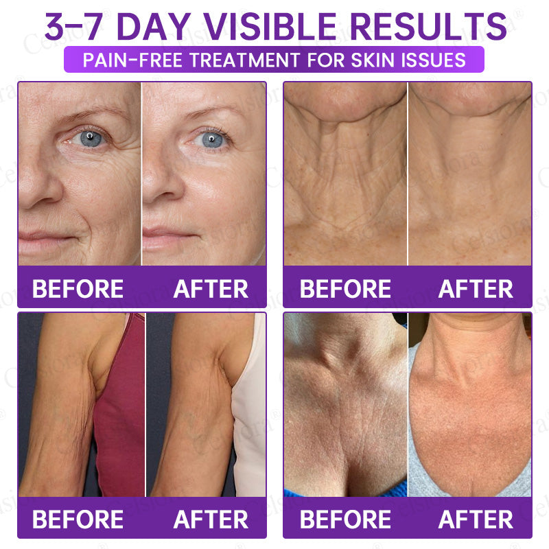 🥈🥈💫Celsiora® Botox & PDRN Anti-Wrinkle Shot – Lift & Firming Cream