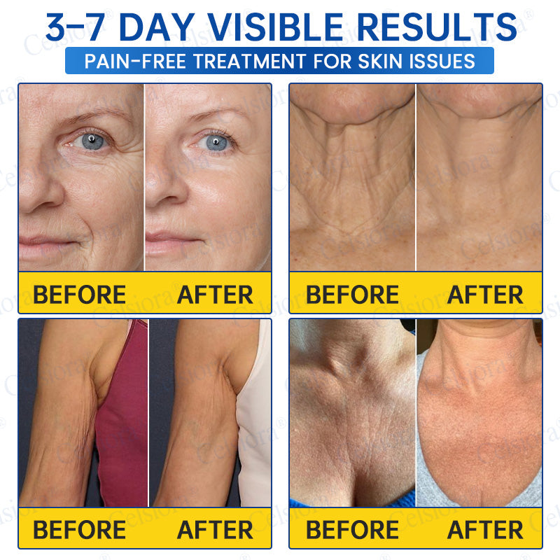 🎁✨Made and shipped from the UK 💫Celsiora® Botox & PDRN Anti-Wrinkle Shot – Lift & Firming Cream- Last Day Promotion 70% OFF