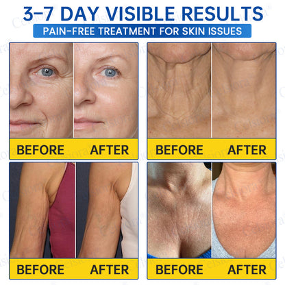 🎁✨Made and shipped from the UK 💫Celsiora® Botox & PDRN Anti-Wrinkle Shot – Lift & Firming Cream- Last Day Promotion 70% OFF