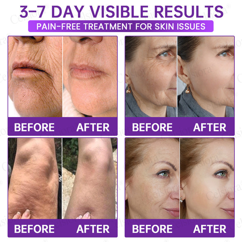 🥈🥈💫Celsiora® Botox & PDRN Anti-Wrinkle Shot – Lift & Firming Cream