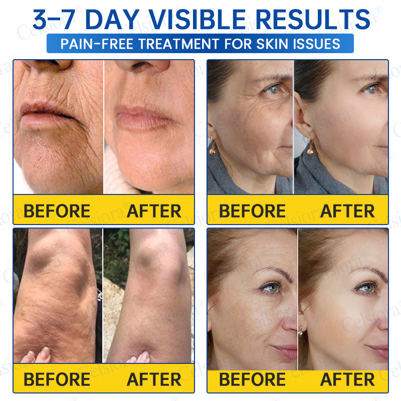 🎁✨Made and shipped from the UK 💫Celsiora® Botox & PDRN Anti-Wrinkle Shot – Lift & Firming Cream- Last Day Promotion 70% OFF