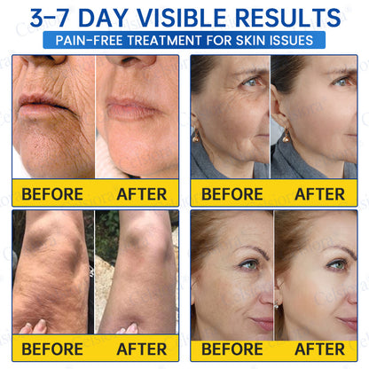 🎁✨Made and shipped from the UK 💫Celsiora® Botox & PDRN Anti-Wrinkle Shot – Lift & Firming Cream- Last Day Promotion 70% OFF