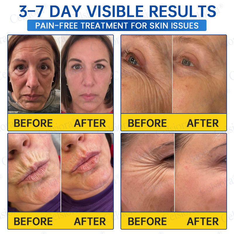 🎁✨Made and shipped from the UK 💫Celsiora® Botox & PDRN Anti-Wrinkle Shot – Lift & Firming Cream- Last Day Promotion 70% OFF