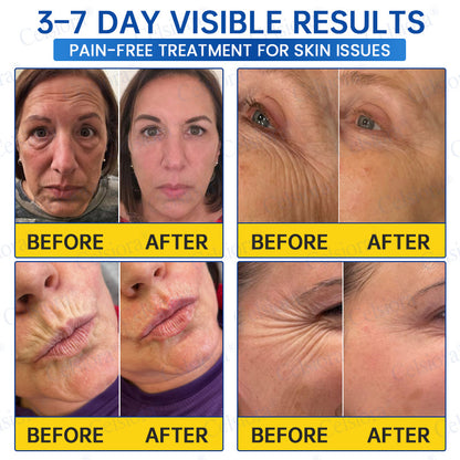 🎁✨Made and shipped from the UK 💫Celsiora® Botox & PDRN Anti-Wrinkle Shot – Lift & Firming Cream- Last Day Promotion 70% OFF