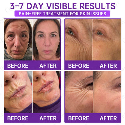 🥈🥈💫Celsiora® Botox & PDRN Anti-Wrinkle Shot – Lift & Firming Cream
