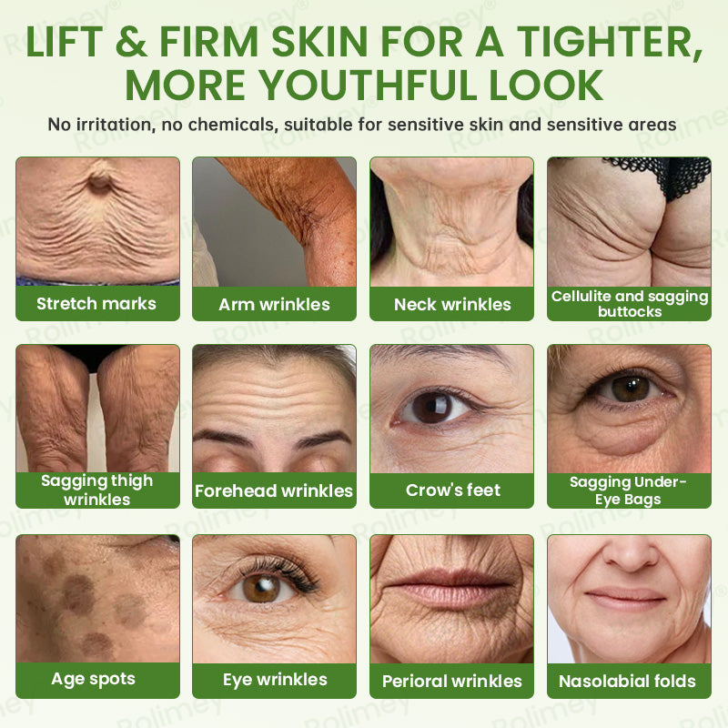 💍🟢Rolimey® Vita-A Retinol Shot Wrinkle-Lift Tightening cream\