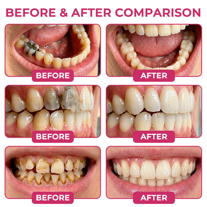 💎 Evolvion® Nano-HAp Enamel Renewal Gel – Advanced Enamel Defense & Tooth Care🦷