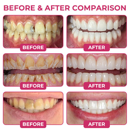 💎 Evolvion® Nano-HAp Enamel Renewal Gel – Advanced Enamel Defense & Tooth Care🦷