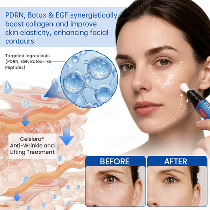 🎁✨Made and shipped from the UK 💫Celsiora® Botox & PDRN Anti-Wrinkle Shot – Lift & Firming Cream- Last Day Promotion 70% OFF